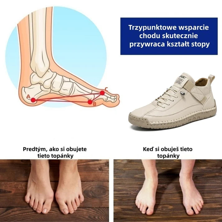 Ostatni dzień! 50% zniżki! ✅ Ortopedyczne obuwie medyczne zaprojektowane specjalnie dla osób z problemami stóp, aby uśmierzyć ból pleców, stawów i stóp.