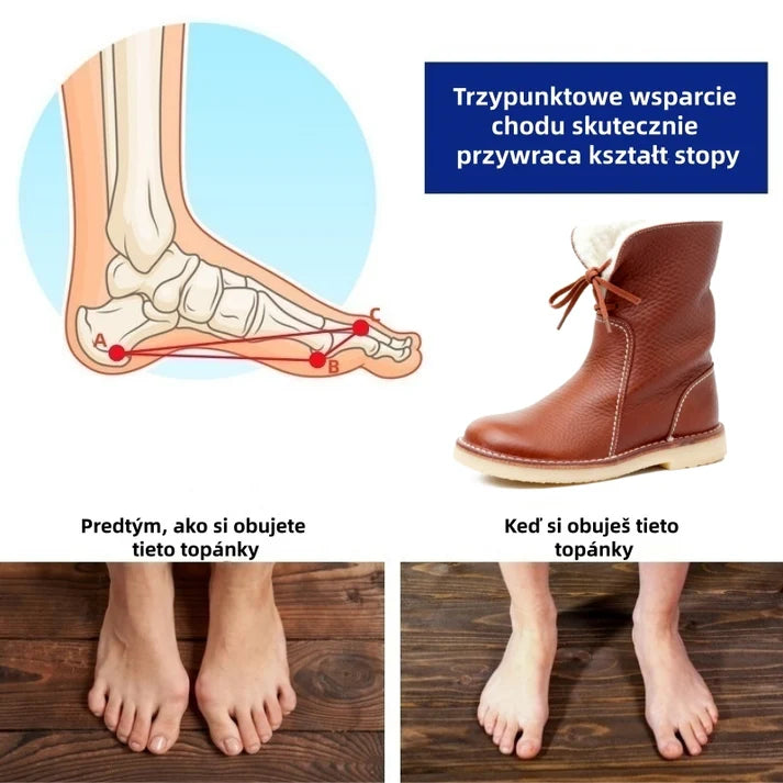 🎉 Dzisiejsza okazja: 50% taniej – nie przegap! ⏰ Ergonomiczne, ortopedyczne buty zimowe, które skutecznie łagodzą ból stóp, kolan i pleców.