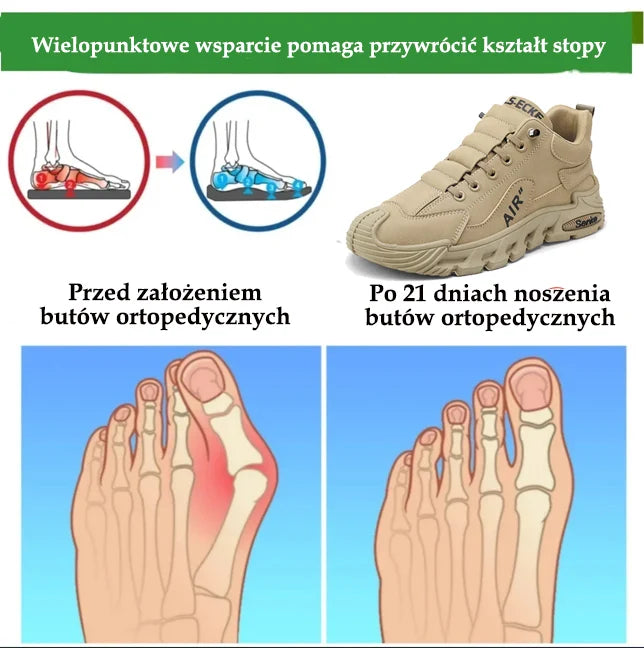 ⏰Oferta ograniczona czasowo – wkrótce wygaśnie✅Najnowszej generacji buty trekkingowe z podparciem łuku stopy i funkcją korygującą chód